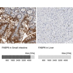 FABP6 Antibody, Novus Biologicals 25 &mu;L | Buy Online | Novus Biologicals | Fisher Scientific